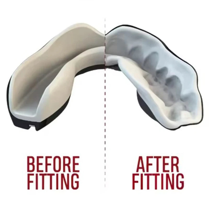 Children's Boxing Sports Mouth Guard Free Combat MMA Combat Free Combat Taekwondo Protective Gear